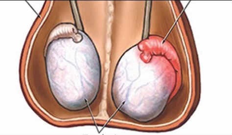 Illustration: April is Testicular Cancer Awareness Month