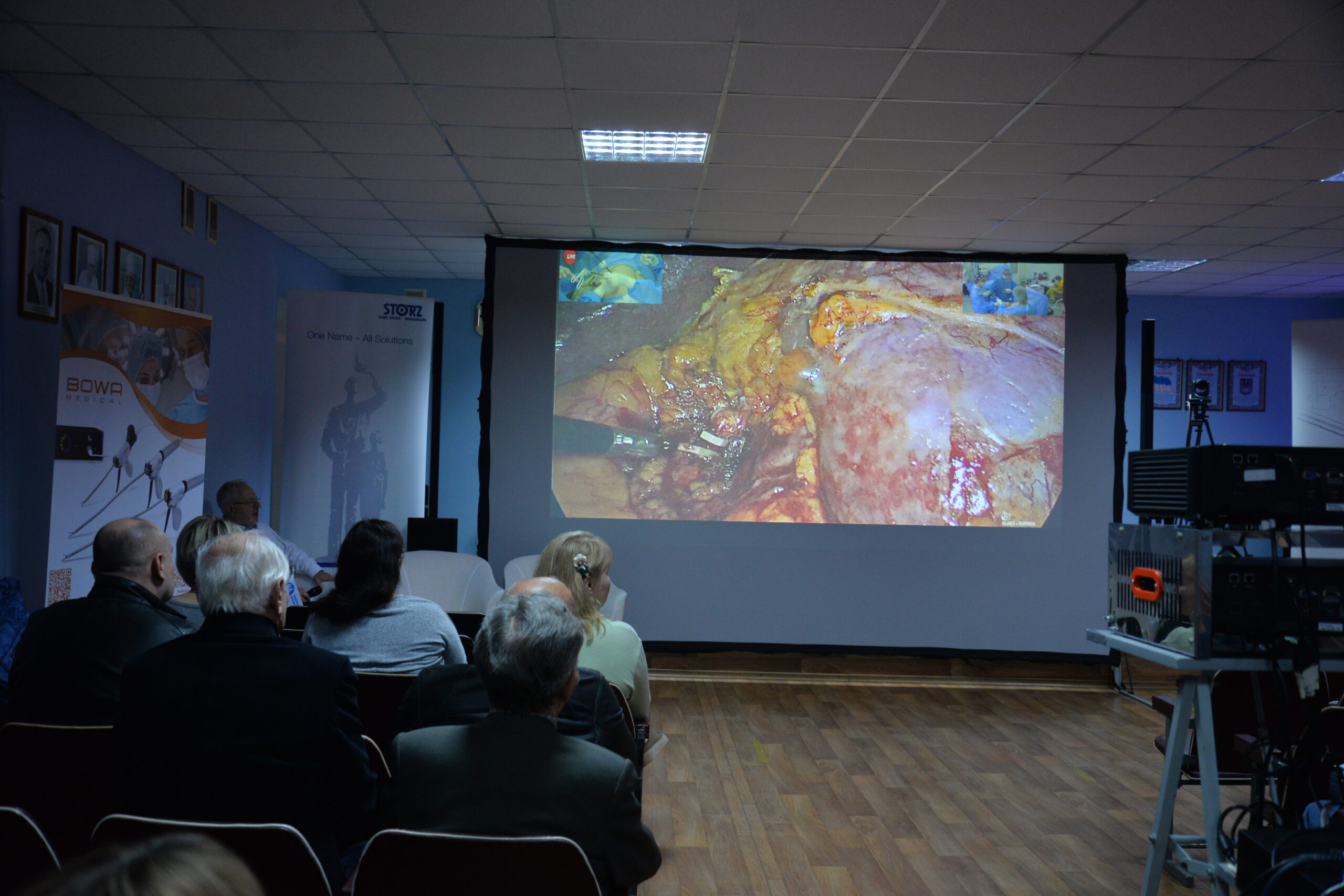 3D technologies in laparoscopy