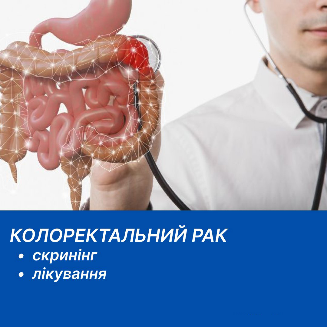 Illustration: Colorectal cancer: screening and treatment