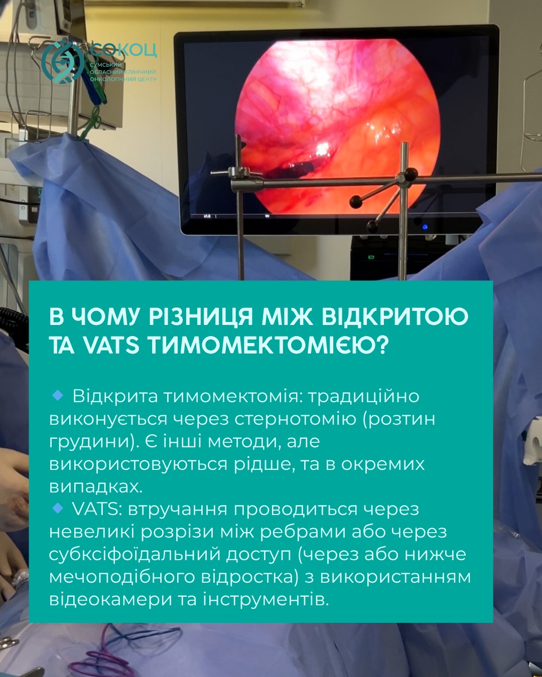 Illustration: What is a thymoma and why is it important to see a doctor in time?
