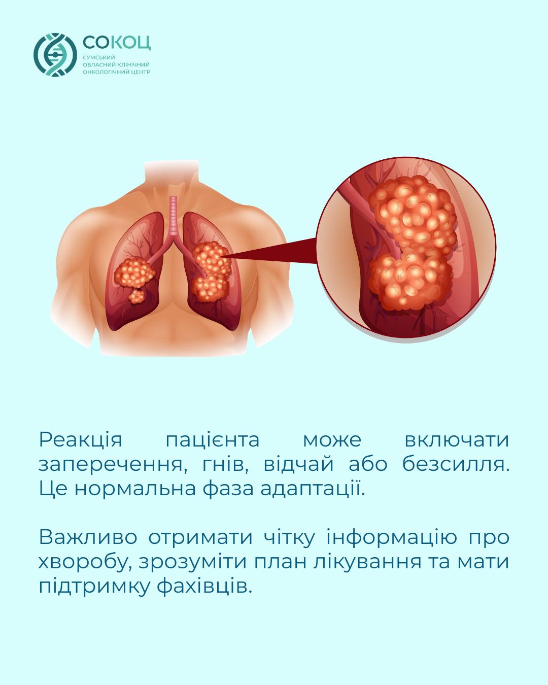 Illustration: Lung cancer